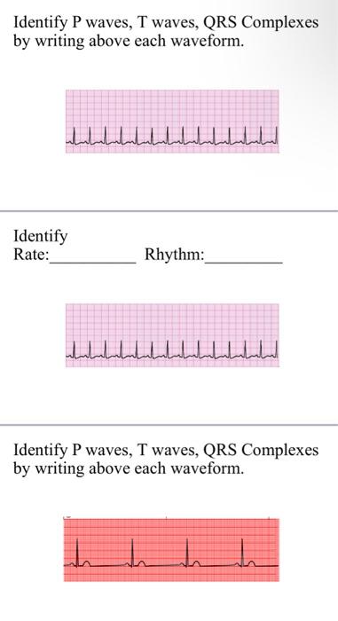 Solved Identify Rate: Rhythm: h Identify P waves, T waves, | Chegg.com