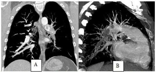 38-year-old male patient Reason for admission: | Chegg.com
