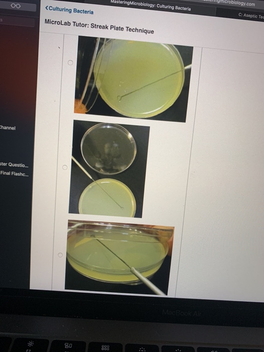 Solved MicroLab Tutor Streak Plate Technique Part D Which