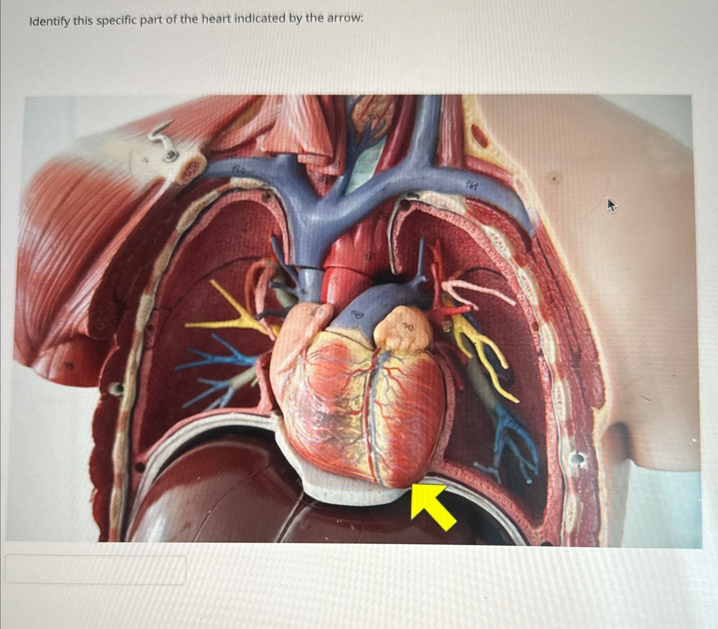 Solved Identify this specific part of the heart indicated by | Chegg.com
