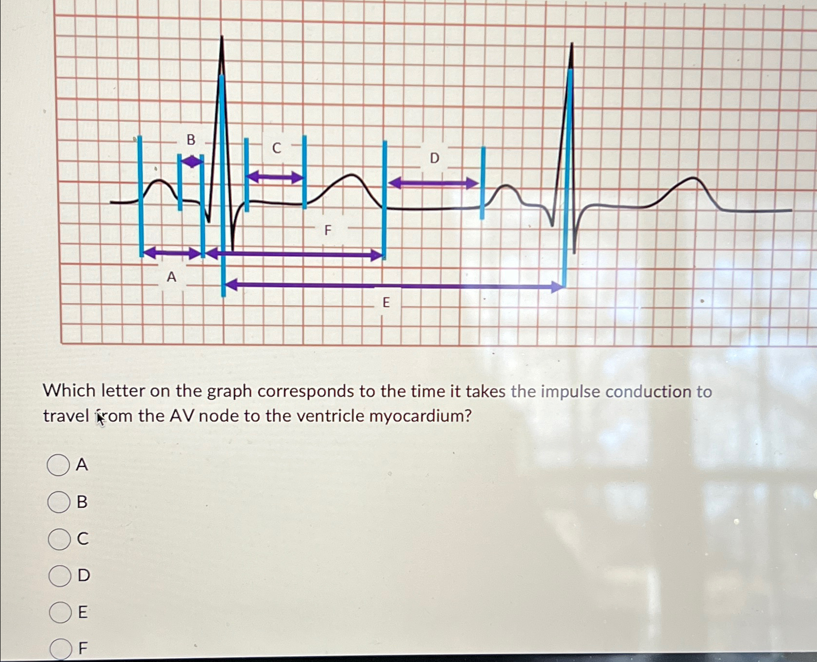 Solved Which letter on the graph corresponds to the time it | Chegg.com