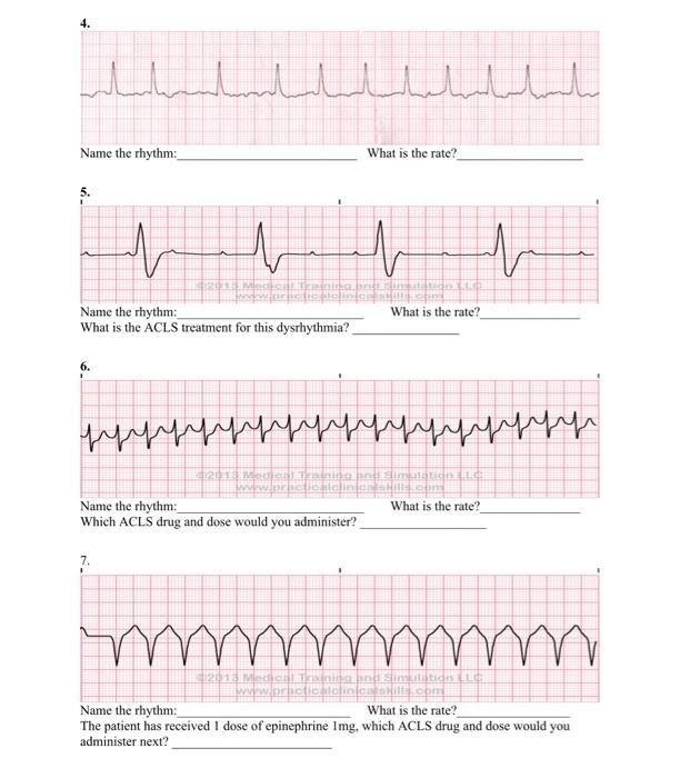 Solved Name the rhythm: What is the rate? What is the ACLS | Chegg.com