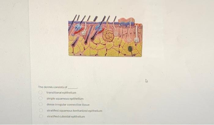 Solved The dermis consists of transitional epithelium simple | Chegg.com