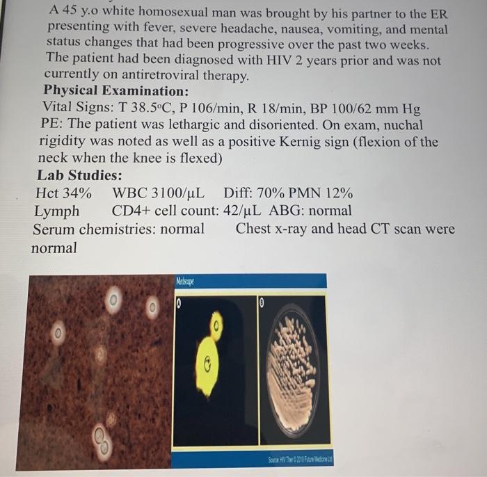 A 45 y.o white homosexual man was brought by his partner to the ER presenting with fever, severe headache, nausea, vomiting,