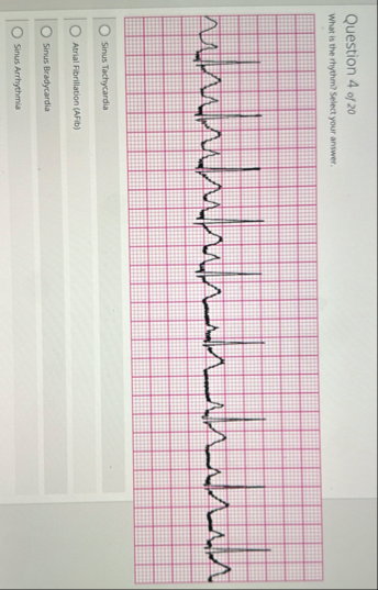 Solved uestion 4 ﻿of 20What is the rhythm? ﻿Select your | Chegg.com