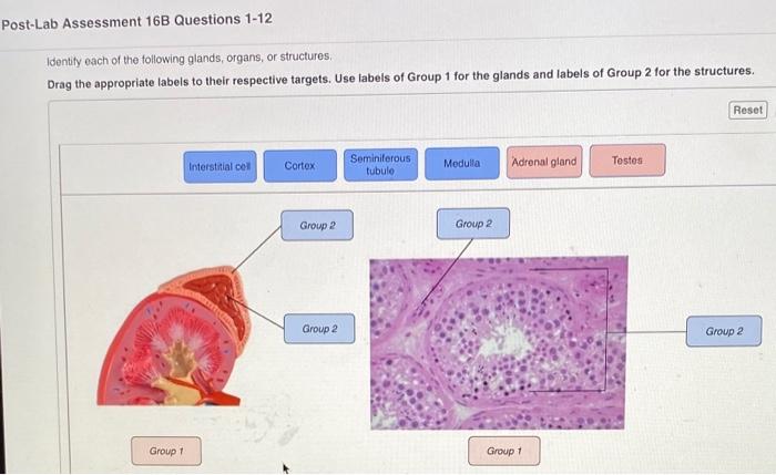 Solved Post-Lab Assessment 16B Questions 1-12 Identity Each | Chegg.com