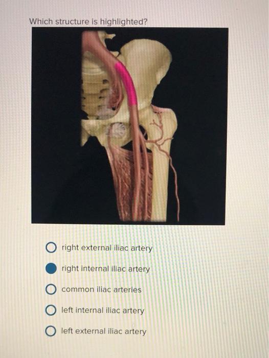 solved-which-structure-is-highlighted-right-external-iliac-chegg