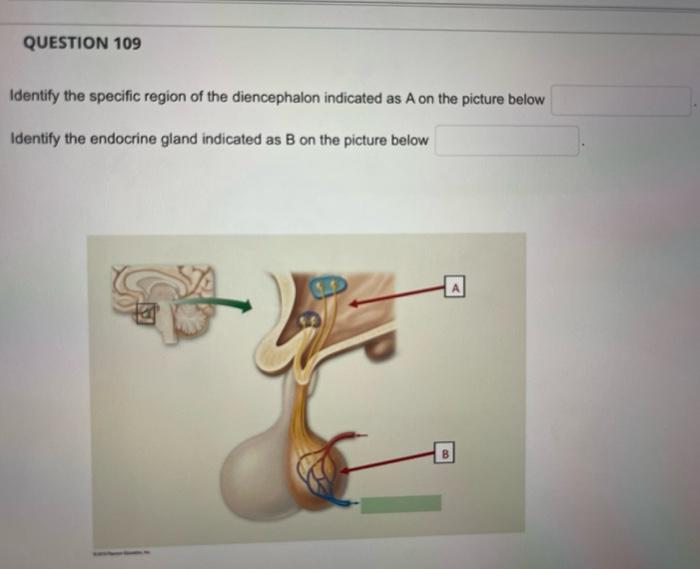 Identify the specific region of the diencephalon indicated as A on the picture below
Identify the endocrine gland indicated a