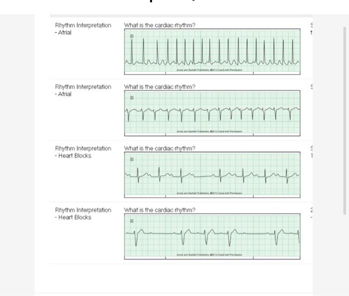 Solved Rhythm Interpretation - Atrial What is the cardiac | Chegg.com