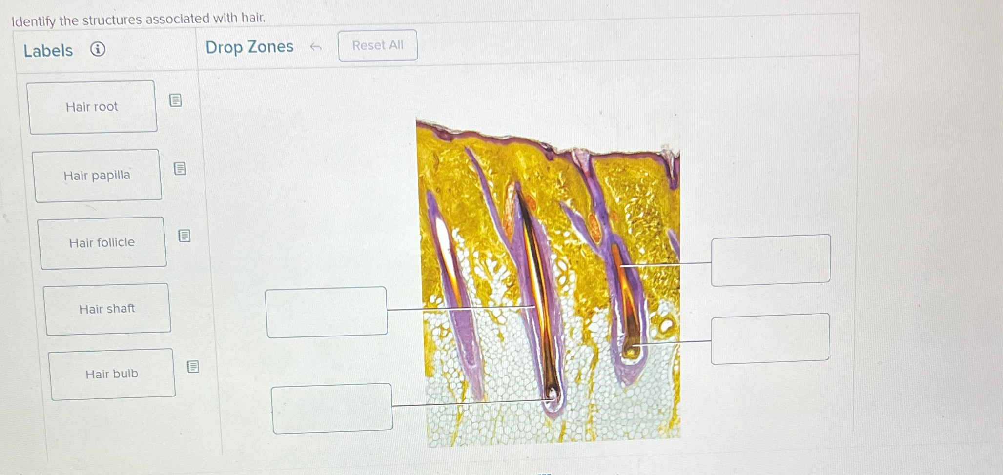 Solved Identify the structures associated with | Chegg.com