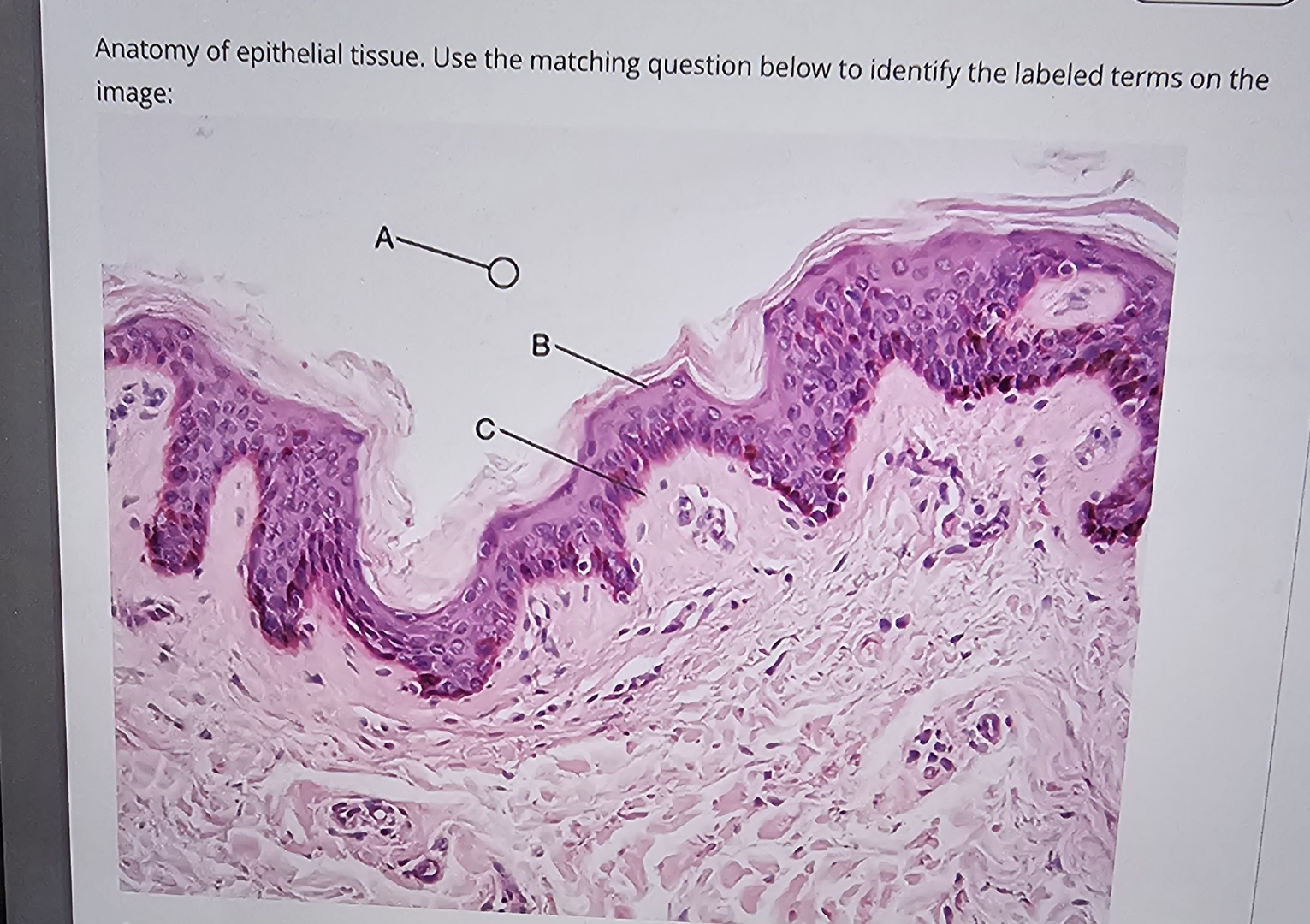 Solved Anatomy of epithelial tissue. Use the matching | Chegg.com