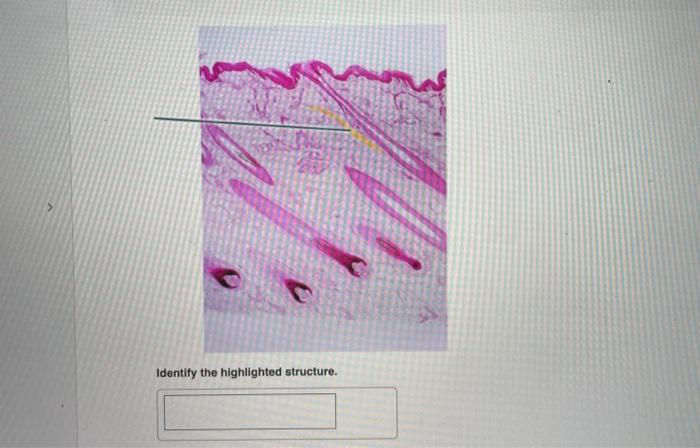 Solved Identify the highlighted structure. | Chegg.com