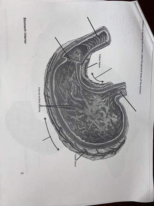 Solved Stomach, duodenum & pancreas Label Esophagus Stomach | Chegg.com