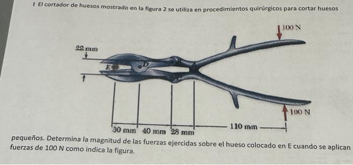 I El cortador de huesos mostrado en la figura 2 se utiliza en procedimientos quirúrgicos para cortar huesos pequeños. Determi