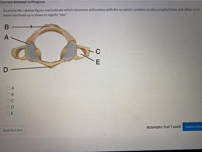 Solved which structure articulates with the occipital