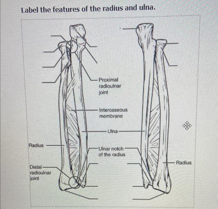 Solved Label the features of the radius and ulna. Proximal | Chegg.com