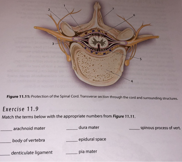 Solved Figure 11.11: Protection of the Spinal Cord. | Chegg.com