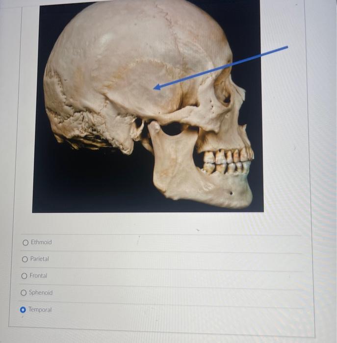 Ethmoid
Parietal
Frontaf
Sphenoid
Temporal