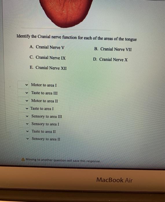 Solved II. Identify the Cranial nerve function for each of | Chegg.com