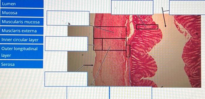 Solved Lumen Mucosa Muscularis mucosa Musclaris externa | Chegg.com