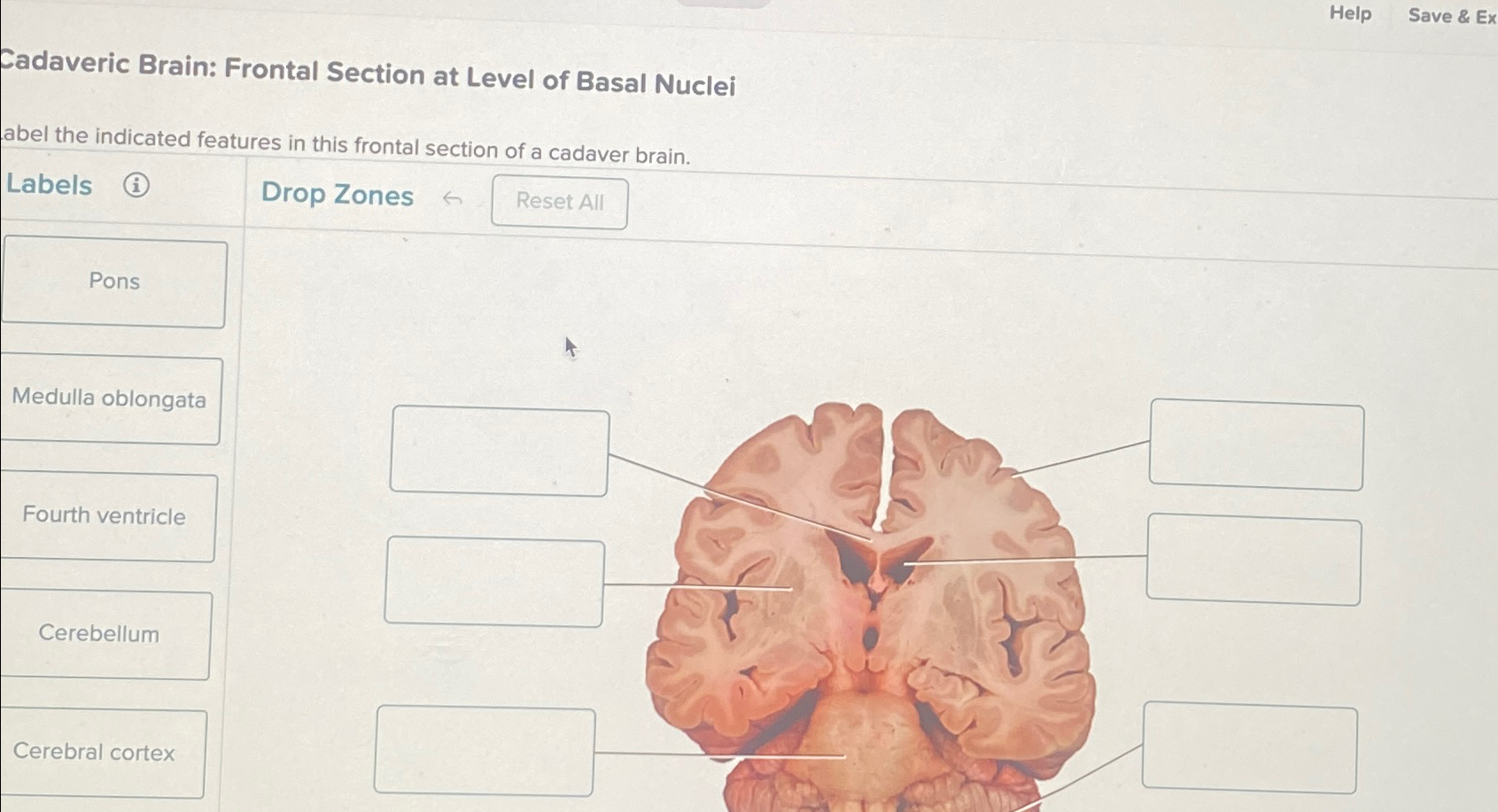 HelpSave & ExCadaveric Brain: Frontal Section at | Chegg.com