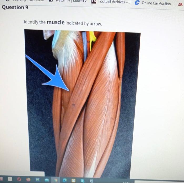 Solved Question 1 Briefly describe the action of the muscle | Chegg.com