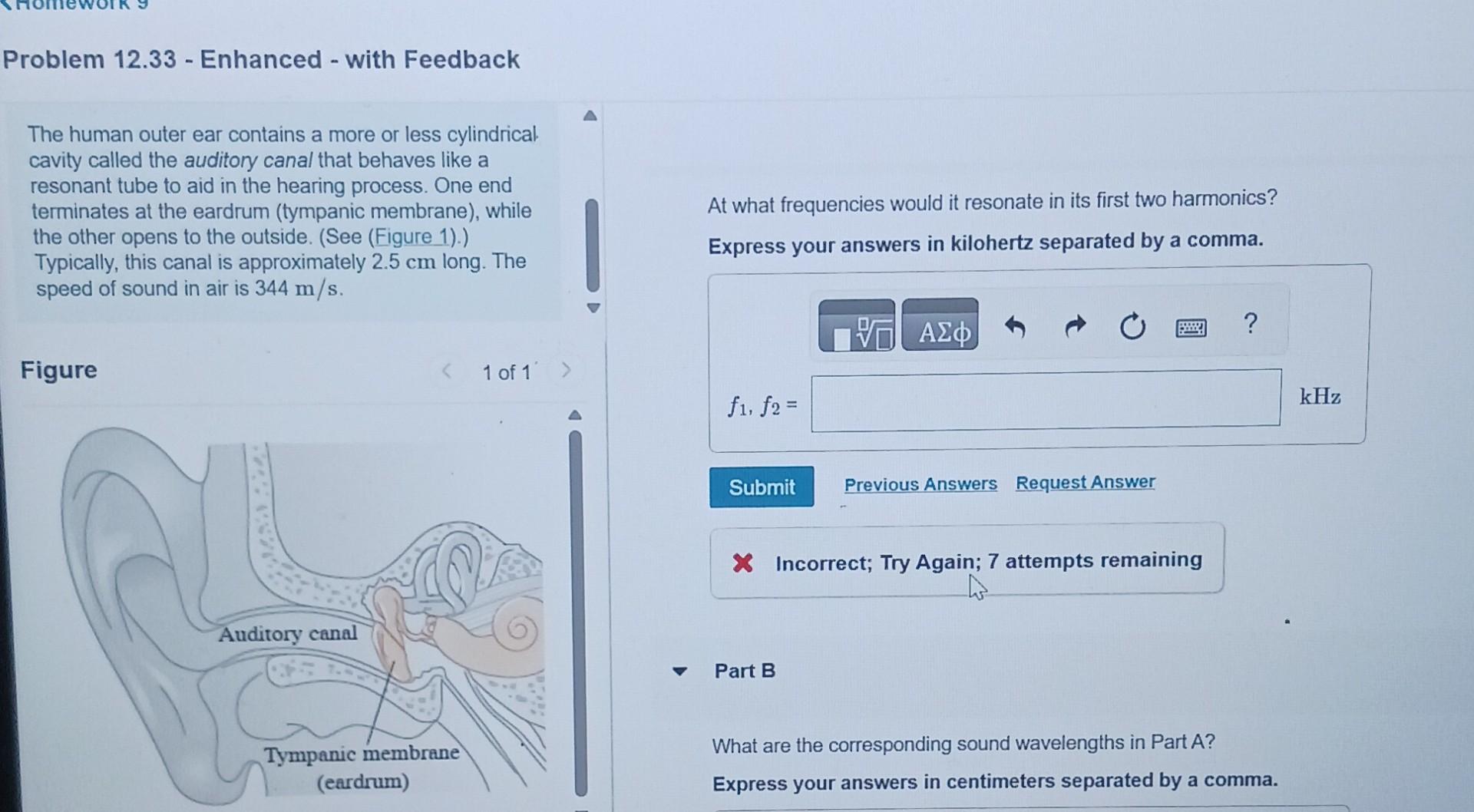 Solved The human outer ear contains a more or less | Chegg.com