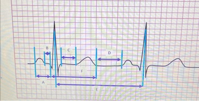 Solved Which letter on the graph corresponds to the time it | Chegg.com