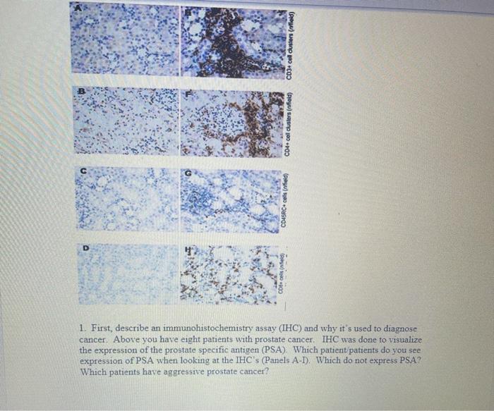 CO3. oil dusters (Mild) C04 col clusters (offield) CD4SRC (ned) D 1. First, describe an immunohistochemistry assay (IHC) and