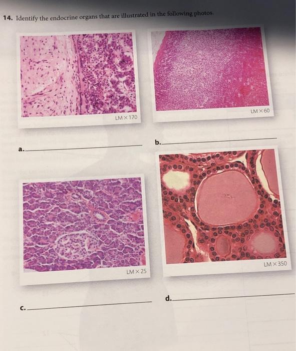 14. Identify the endocrine organs that are | Chegg.com