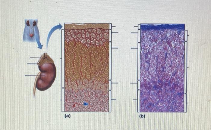 Solved Label the following diagram (a) (b) | Chegg.com