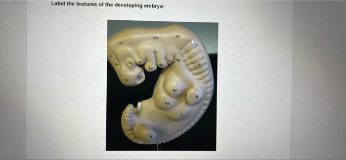 Solved Label the features of the developing embryo: | Chegg.com