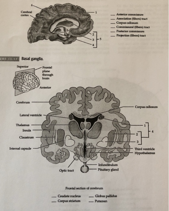 Solved EXERCISE THIRTEEN. Nervous System 299 FICURE 13.3 | Chegg.com