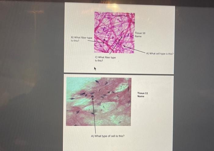 Solved A) What type of cell is this? | Chegg.com