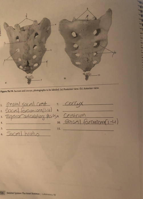 Solved Thoracic Vertebra Observe A Thoracic Vertebra And 