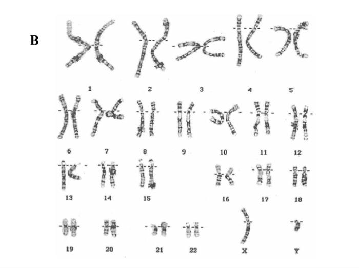 Solved Karyotype Lab Chromosome structure and chromosome | Chegg.com