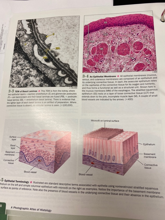 solved-1-2-epithelium-superior-view-3-1-pp-29-chegg