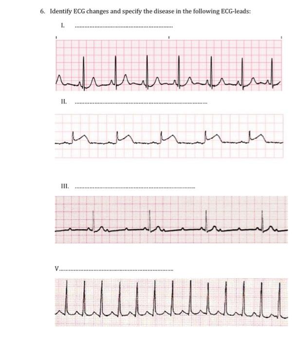 Solved 6. Identify ECG changes and specify the disease in | Chegg.com