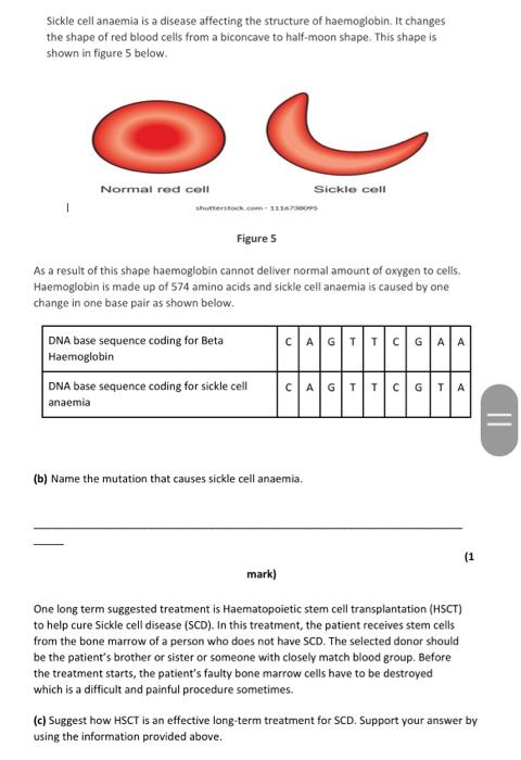 St. Jude Research on X: People with sickle cell disease have red blood  cells that contain mostly hemoglobin S, which causes the red blood cells to  change from a round circle shape