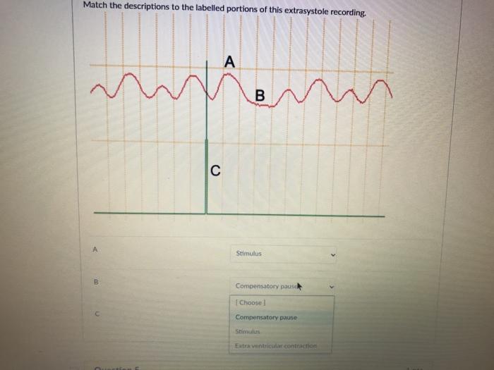 Solved Match the descriptions to the labelled portions of | Chegg.com