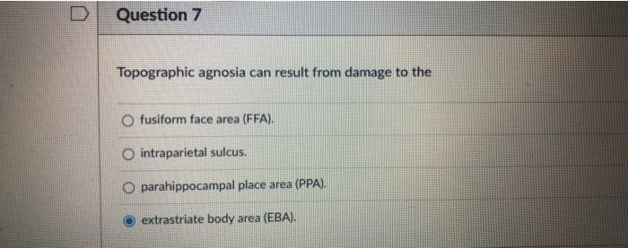 Solved Question 7 Topographic agnosia can result from damage | Chegg.com