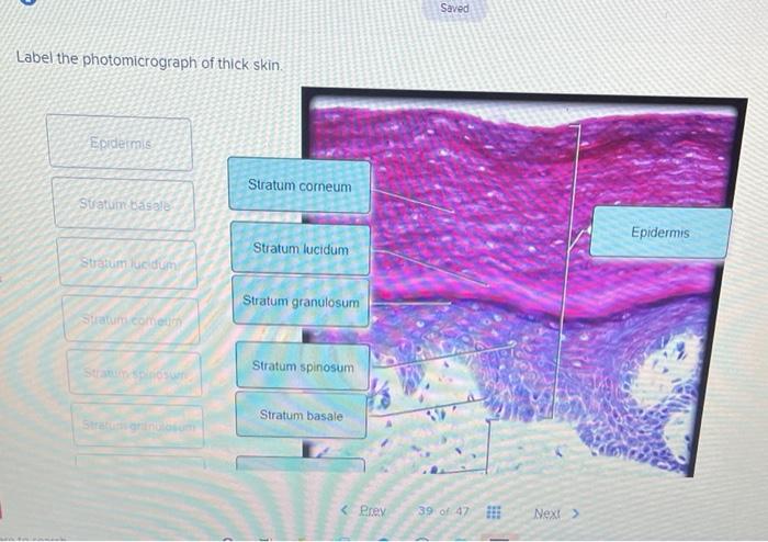 Solved Label the photomicrograph of thick skin. Epidermis | Chegg.com