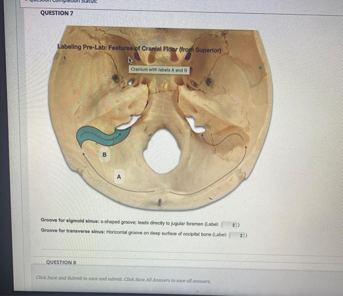 Solved QUESTION 7 Labeling PreLab Features of Cranial