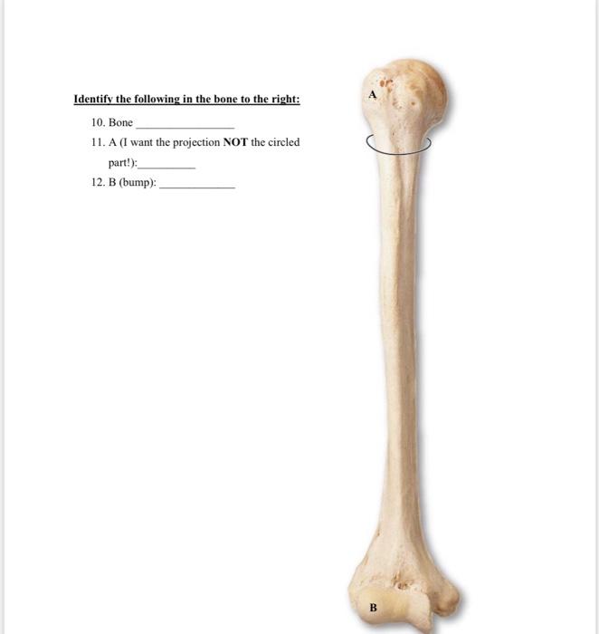 Solved Identify The Following In The Figure Above: 1. Bone | Chegg.com