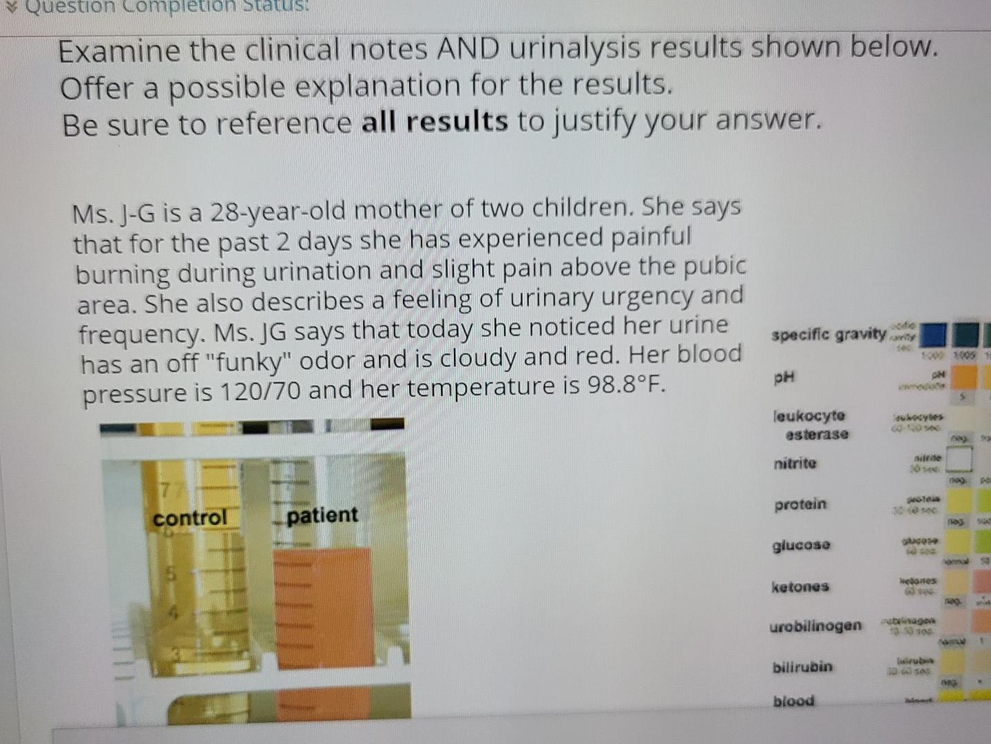 Question completion Status: Examine the clinical notes AND urinalysis results shown below. Offer a possible explanation for t