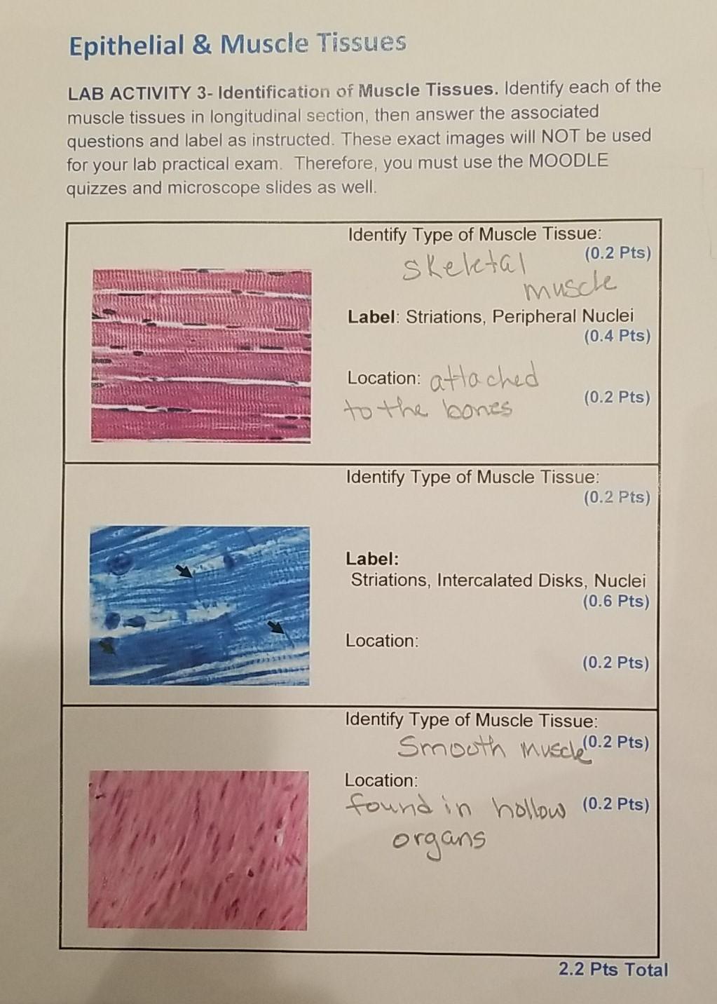 Solved Epithelial & Muscle Tissue Practice Name the small