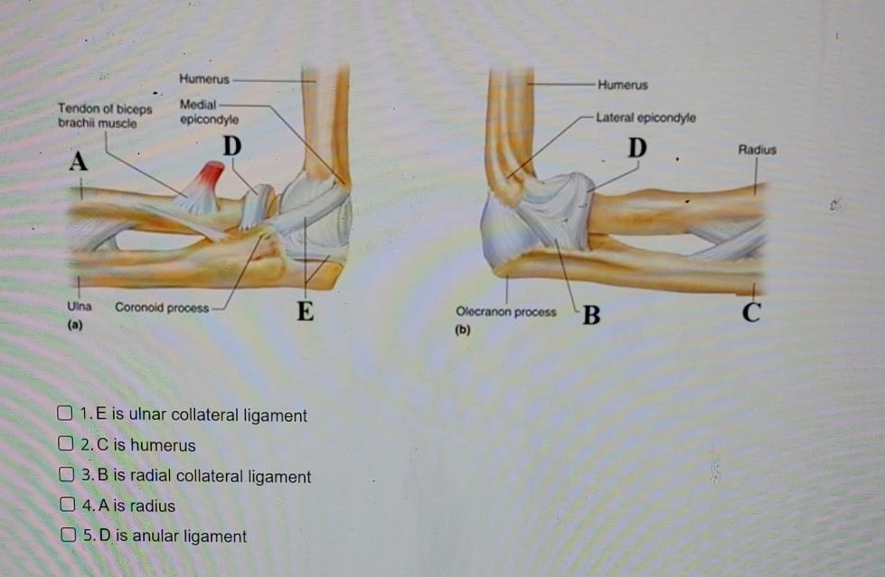 Solved Humerus Humerus Tendon of biceps brachii muscle | Chegg.com