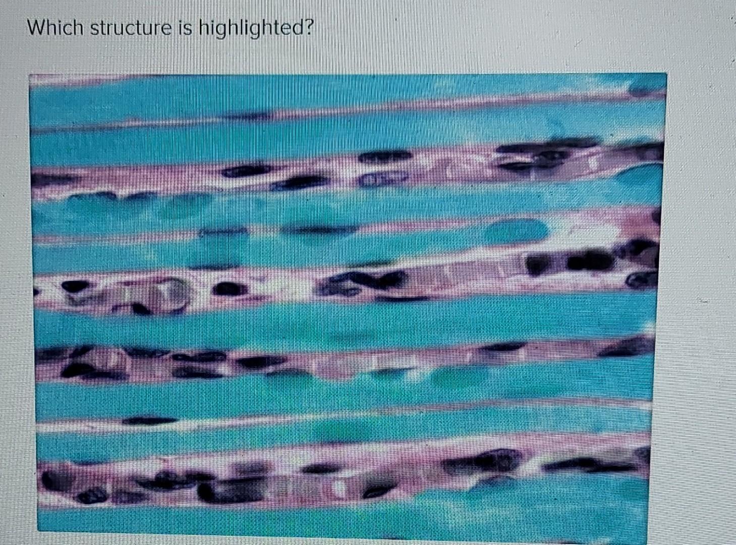 Solved Which structure is highlighted (highlighted in