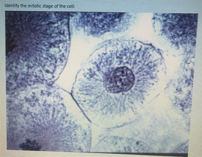 Solved Identify the mitotic stage of the cell: Biology Diagrams