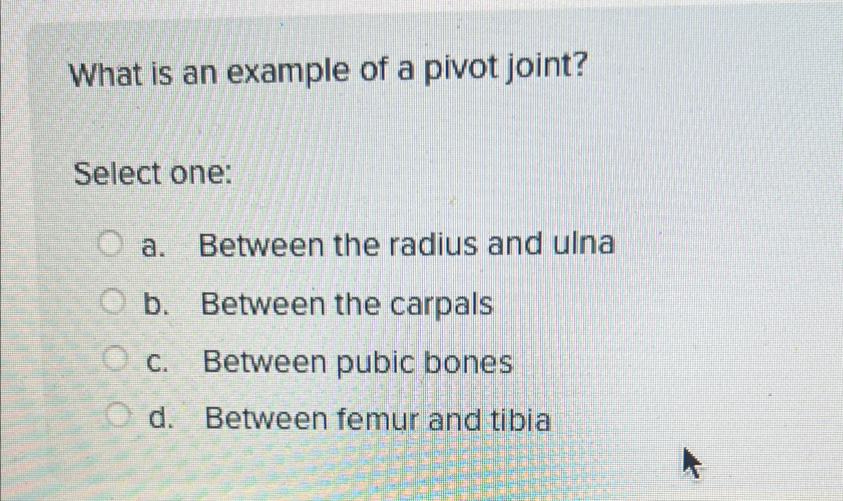 Solved What is an example of a pivot joint?Select one:a. | Chegg.com